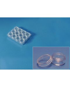 Plastic box contains 12 containers 